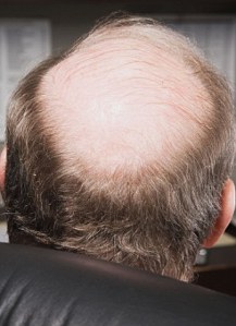 Mature businessman with bald head